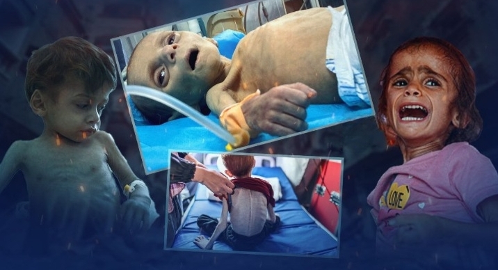 بينما الجوع يفتك بغزة.. أنظمة خليجية تغدق المليارات على المجرم ترامب وتُدير ظهرها لفلسطين