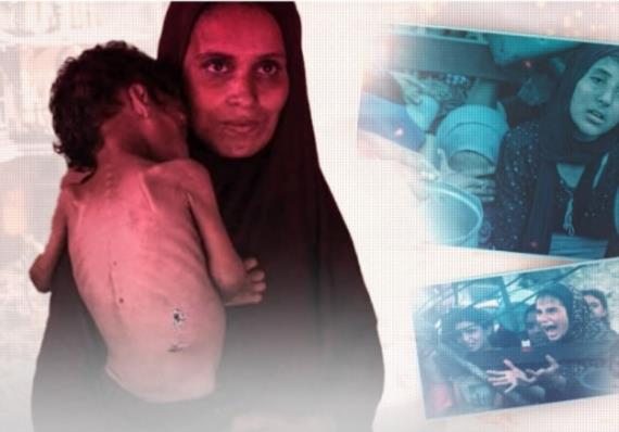 غزة تموت جوعًا، والعالم شريك في الجريمة