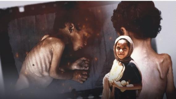 غزة بين القتل قصفاً والقتل تجويعاً