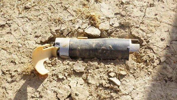 إصابة طفلة بجراح خطيرة جراء انفجار قنبلة عنقودية للعدوان في عمران