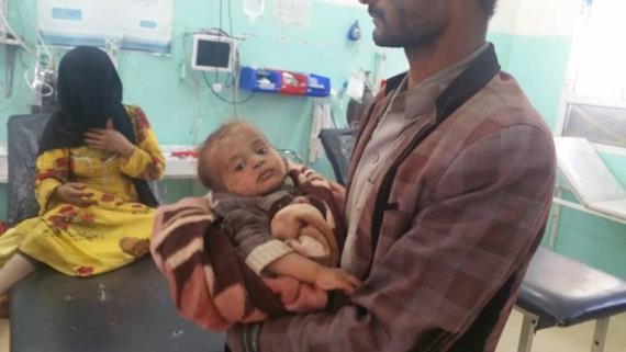 بالأسماء والصور .. 14 شهيد وجريح جلهم أطفال ونساء حصيلة مجزرة العدوان في #باقم بـ #صعدة