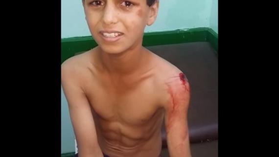 إصابة طفل في غارة لطيران العدوان استهدفت منطقة قحزة بصعدة