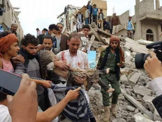 وزارة الصحة تجدد إدانتها لاستمرار العدوان في قصف المدنيين والبنية التحتية وآبار المياه