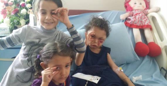 صنعاء : مبادرة نساء اليمن تقوم بزيارة للطفلة #بثينة الناجية الوحيدة من #مجزرة_عطان