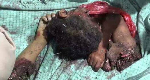 شهيدان في جريمة ثانية لطيران العدوان في باقم بصعدة