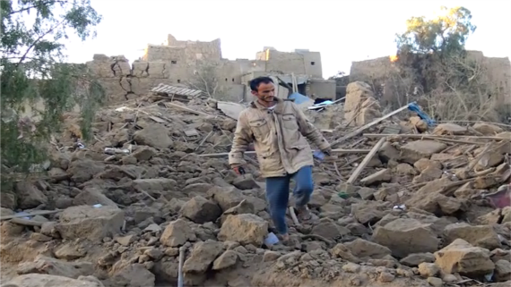 إصابة طفل في غارة للعدوان بصعدة