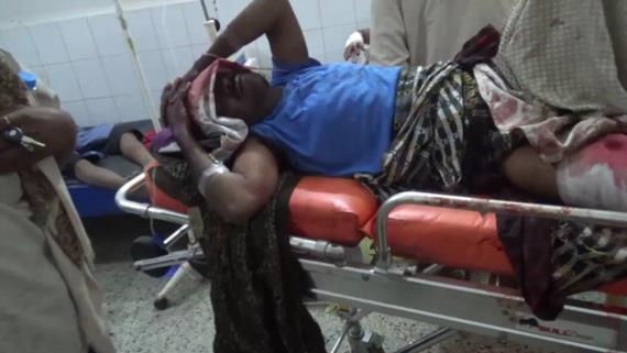 ارتفاع حصيلة جريمة العدوان في زبيد إلى 5 شهداء و 8 جرحى