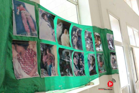 معرض صور بجامعة صنعاء لفضح جرائم العدوان بحق أطفال اليمن