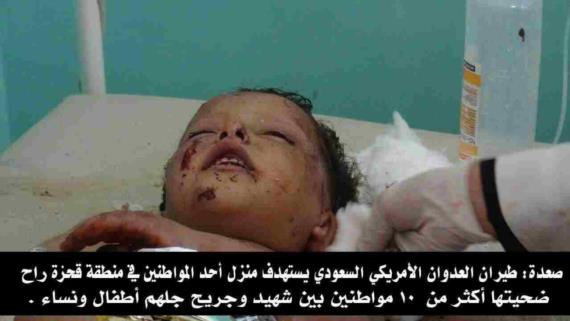 استشهاد واصابة ١.٩ مواطنا في صعدة خلال شهر فبراير المنصرم