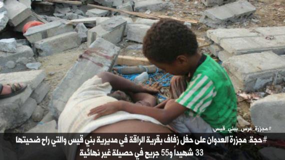 المركز اليمني لحقوق الإنسان يدين مجزرة العدوان بحجة ويستنكر صمت المجتمع الدولي