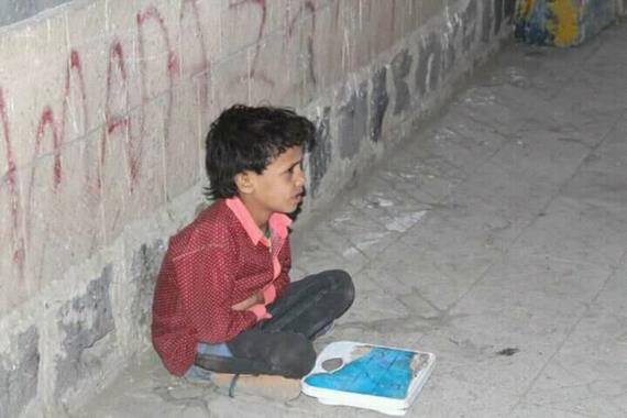 طفل الميزان.. طفل من بلاد الحرب المنسية