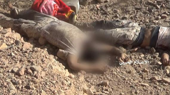 قتلى وجرحى وتدمير آلية في عمليات متفرقة في جبهات الحدود