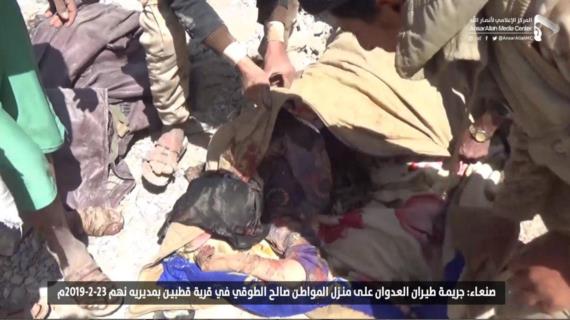الصحة تدين جريمة العدوان الغاشم بحق المواطنين في نهم