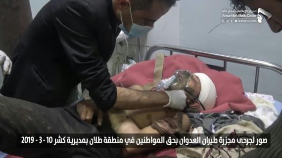 مركز حقوق الإنسان يدعو شعوب العالم للضغط على حكوماتها لقطع العلاقات مع دول العدوان على اليمن