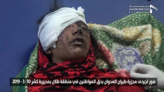مؤسسة واحة الشهداء تدين مجزرة العدوان بحق النساء والأطفال في كشر بحجة