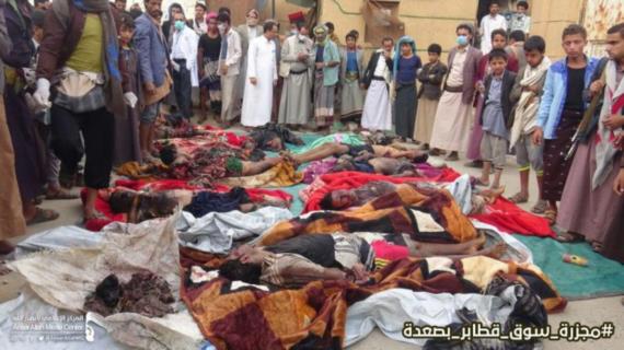 وزير الصحة يحمل النظام الأمريكي مسؤولية جريمة العدوان في صعدة
