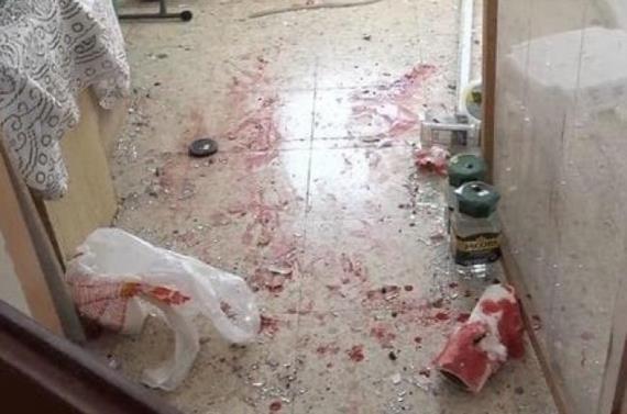 جريحان صهيونيان بقصف سرايا القدس لمدينة عسقلان