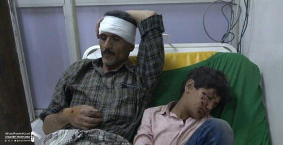 إصابة خمسة مواطنين من أسرة واحدة في قصف للعدوان بالقنابل العنقودية على الصباحة بصنعاء
