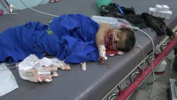 وزارة حقوق الإنسان تدعو مجدداً إلى اتخاذ موقف جاد تجاه جرائم العدوان
