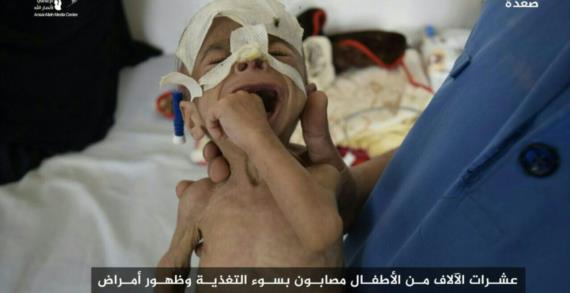 الحصارُ عدوانٌ وحربٌ .. وَرَدُّ اليمن لن يتأخر!
