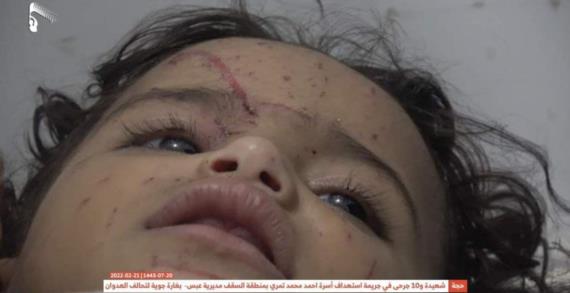 وزارة حقوق الإنسان تدين استمرار جرائم العدوان بحق الشعب اليمني